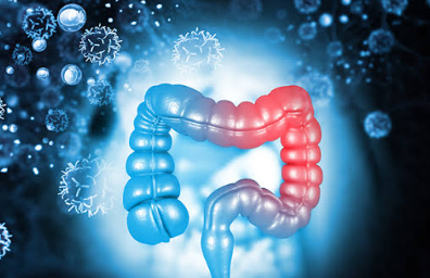 Signs of Colon Cancer - Dr . Sandeep Nayak