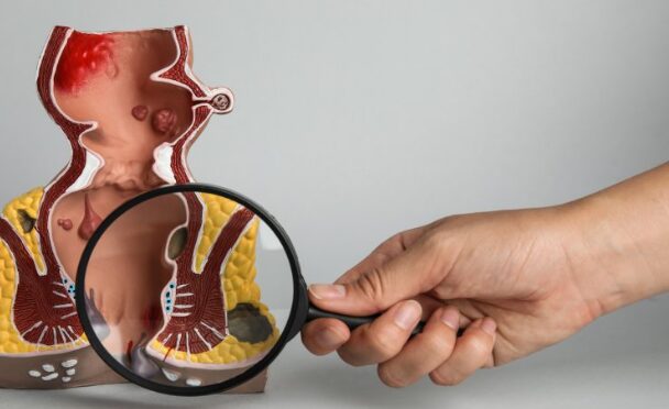 Educational anatomical model of the digestive tract with a magnifying glass focusing on the intestines, highlighting the colon area