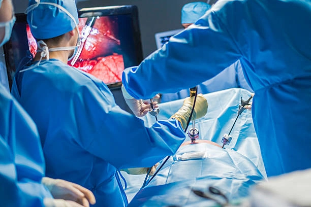 Surgeons in blue gowns perform an operation, using instruments while a monitor shows the patient’s interior during the procedure.