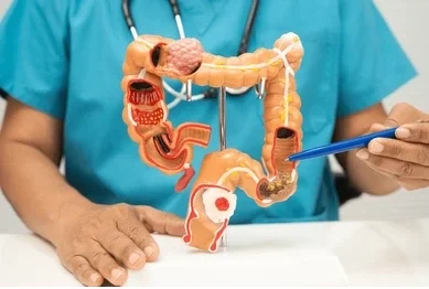 Healthcare worker demonstrates a life-size model of the human digestive system on a stand, pointing with a blue pointer.