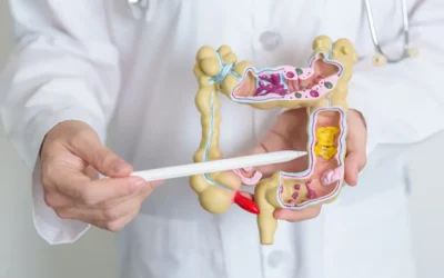 Can International Patients Get Colorectal Surgery at MACS?