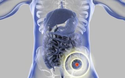 Wait and Watch for Rectal Cancer: An Overview
