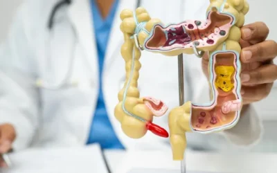What Is a Colonoscopy and When Do You Need One?