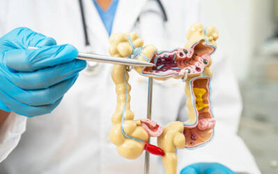 What Is Rectal Cancer Surgery Recovery Like?