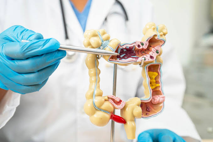 Rectal Cancer Surgery Recovery